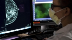 What COVID is teaching doctors about the relationship between viruses and cancer